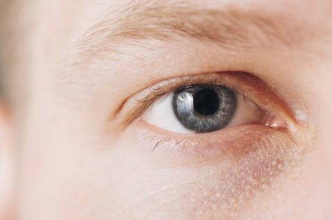 Catarata Nos Olhos: Causas, Sintomas, Tipos e Tratamento