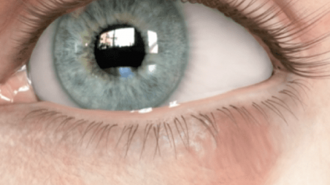Calázio no olho: o que é, tratamento, causas e sintomas
