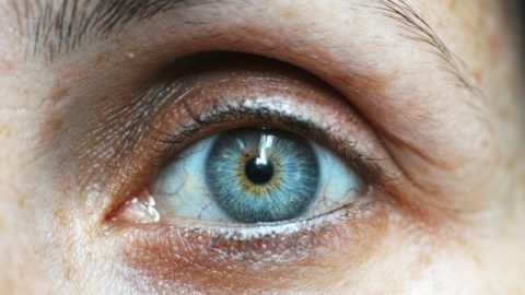 Fotofobia: por que o problema é mais comum em pessoas com olhos claros? -  Signorelli Oftalmologia