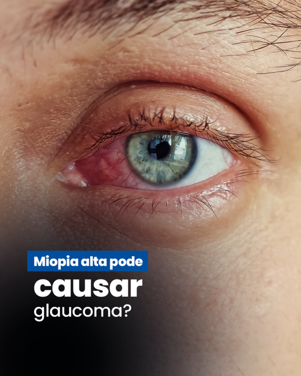 Miopia pode causar glaucoma? 