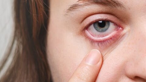 Doença de Behçet: o que é e como ela afeta a saúde dos olhos?