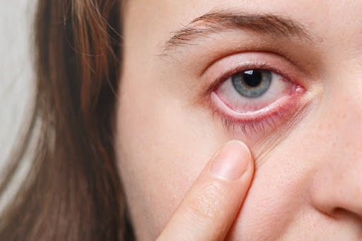Doença de Behçet: o que é como ela afeta a saúde dos olhos?