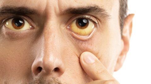 Doenças infecciosas que podem afetar a visão