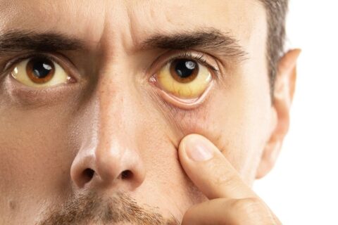 Doenças infecciosas que podem afetar a visão